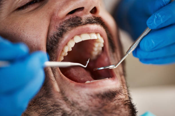 Best Dental Fillings (Composite and Amalgam)  in Brunswick, MD